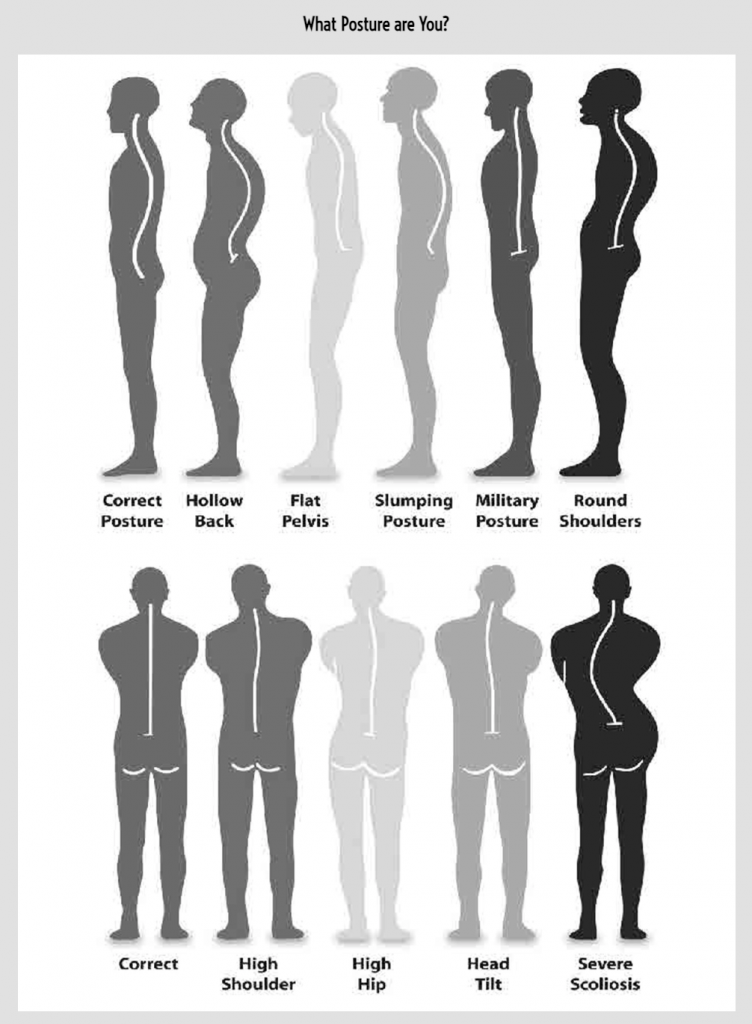 what type of posture do you have